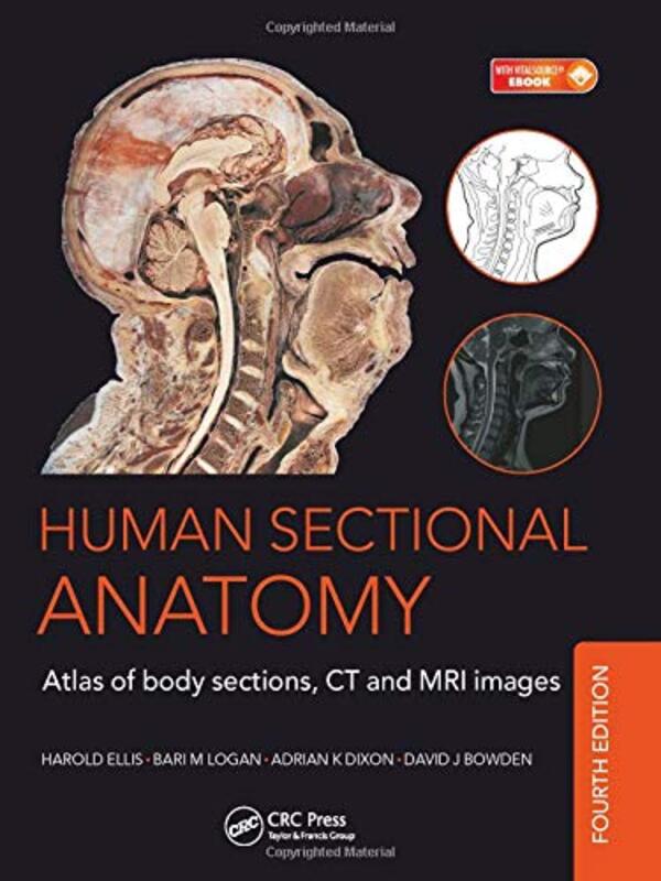 Human Sectional Anatomy: Atlas of Body Sections, CT and MRI Images, Fourth Edition , Hardcover by Dixon, Adrian K. - Bowden, David J. - Ellis, Harold - Logan, Bari M.