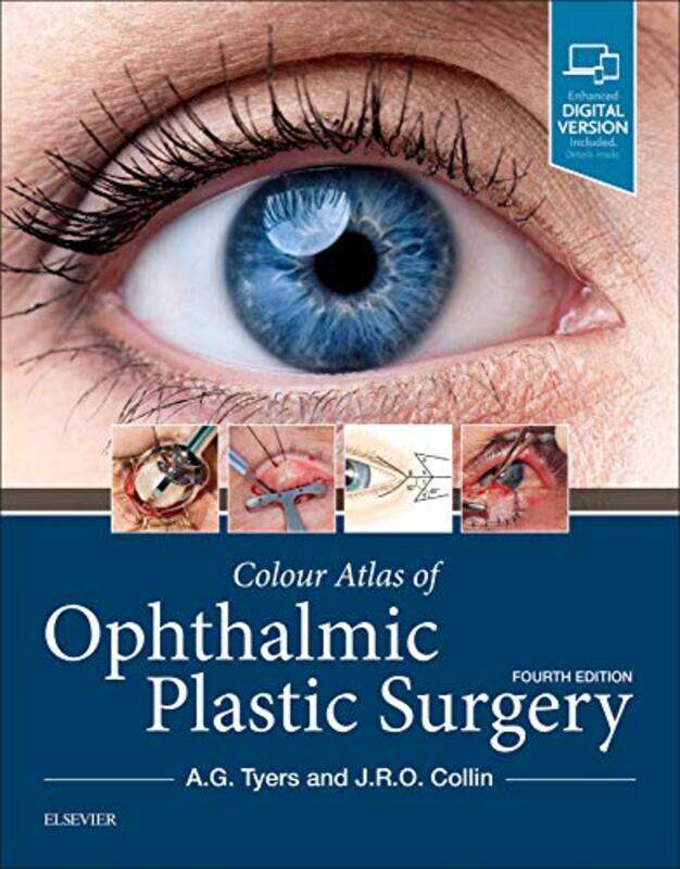 

Colour Atlas of Ophthalmic Plastic Surgery by Lusijah MarxGraham HarrimanRobin McCoy Brooks-Hardcover