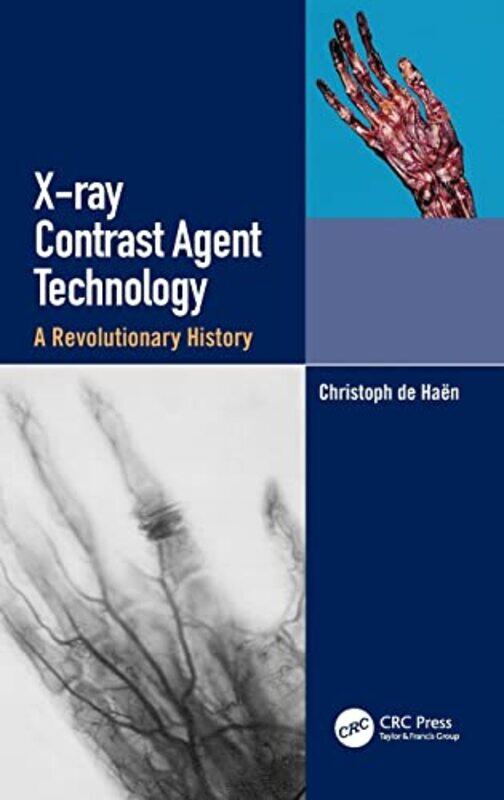 

Xray Contrast Agent Technology by Christoph de Haen-Hardcover