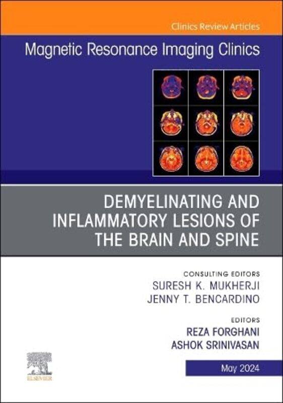 

Demyelinating and Inflammatory Lesions of the Brain and Spine An Issue of Magnetic Resonance Imaging Clinics of North America by Ivy MixLynnette Marre