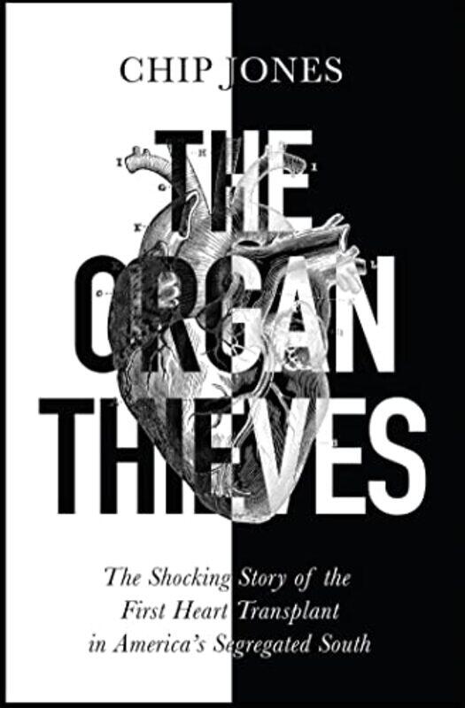 

The Organ Thieves by Chip Jones-Paperback