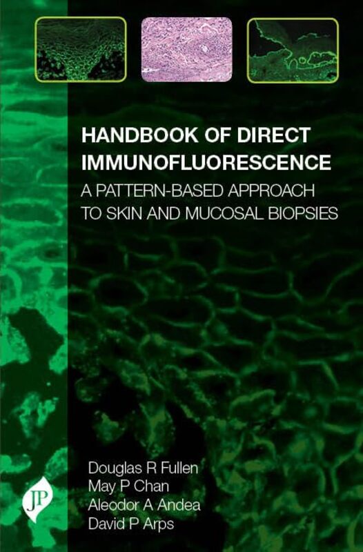 

Handbook of Direct Immunofluorescence by Sophie PageCatherine Rider-Hardcover