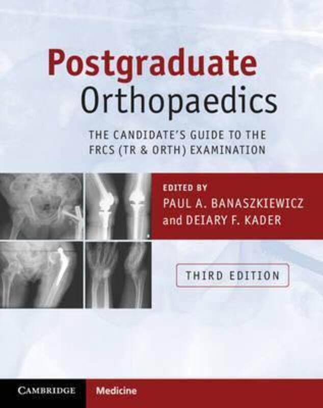 

Postgraduate Orthopaedics: The Candidate's Guide to the FRCS (Tr & Orth) Examination, Paperback Book, By: Paul A. Banaszkiewicz