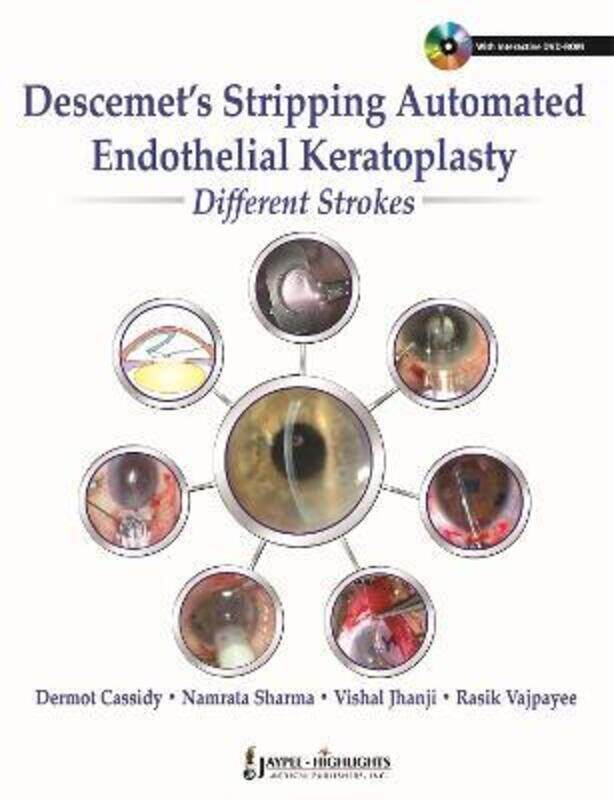 

Descemet's Stripping Automated Endothelial Keratoplasty: Different Strokes,Hardcover,ByCassidy, Dermot - Sharma, Namrata - Jhanji, Vishal - Vajpayee,