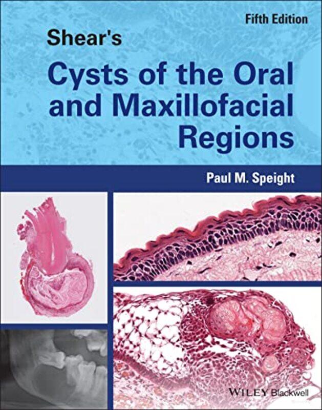 

Shears Cysts of the Oral and Maxillofacial Regions by David McHenry-Hardcover