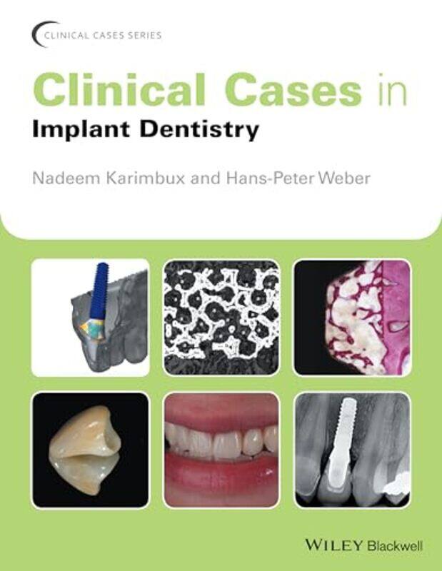 

Clinical Cases in Implant Dentistry by Karimbux, Nadeem (Tufts University School of Dental Medicine, Boston, Massachusetts, USA) - Weber, H Paperback