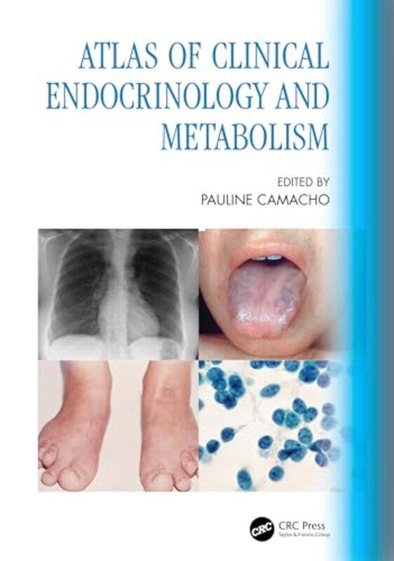 

Atlas of Clinical Endocrinology and Metabolism by Xiao-Gang Department of Physics Massachusetts Institute of Technology USA Wen-Paperback