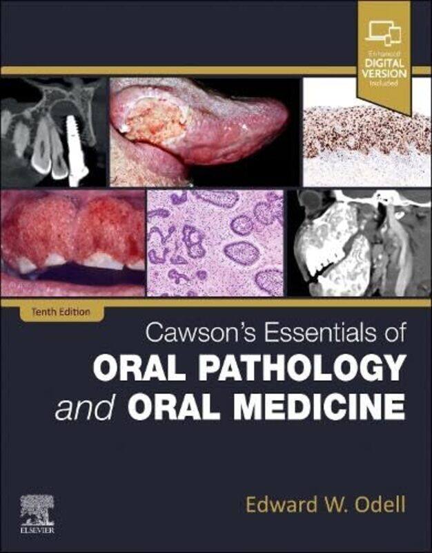 

Cawsons Essentials Of Oral Pathology And Oral Medicine By Odell Edward W Fdsrcs Msc Phd Frcpath Professor Of Oral Pathology And Medicine Kings College