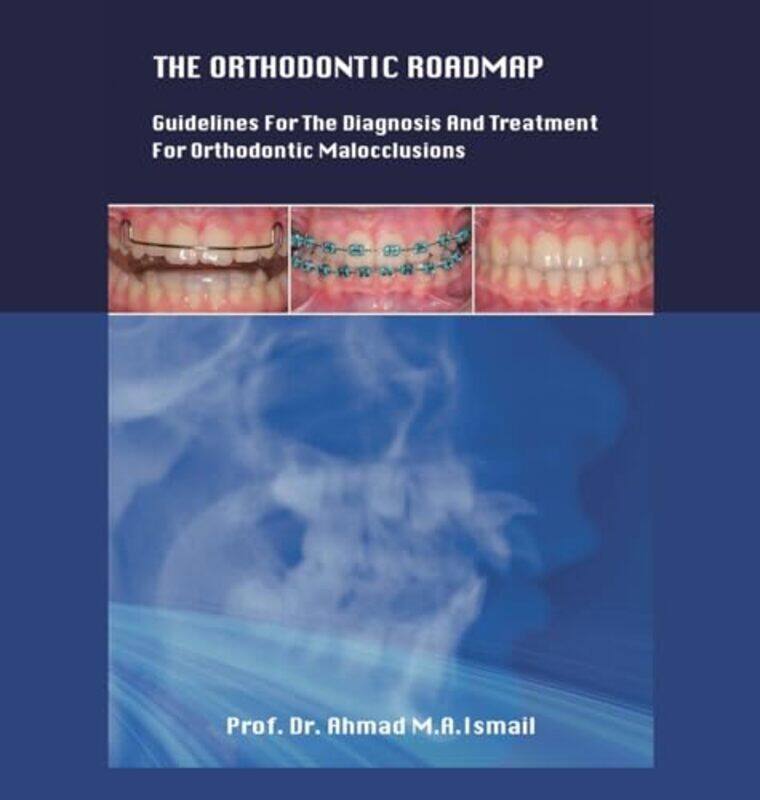 

The Orthodontic Roadmap Guidelines For The Diagnosis And Treatment Of Orthodontic Malocclusions By Ismail, Dr Prof Ahmad M A Hardcover