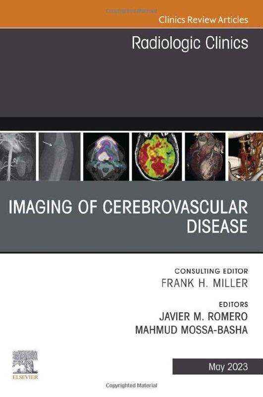 

Imaging of Cerebrovascular Disease An Issue of Radiologic Clinics of North America by Boye Lafayette De Mente-Hardcover