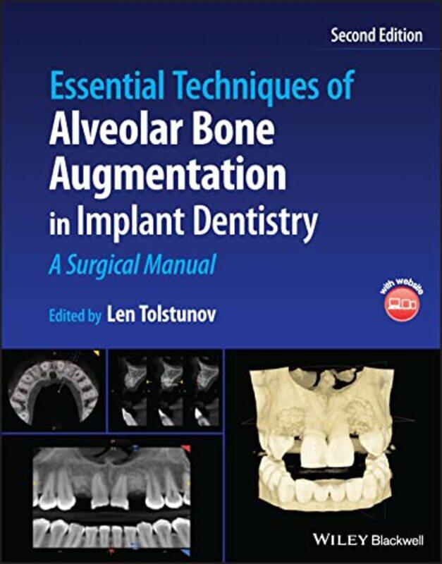 

Essential Techniques of Alveolar Bone Augmentation in Implant Dentistry: A Surgical Manual,Hardcover,by:Tolstunov, Len