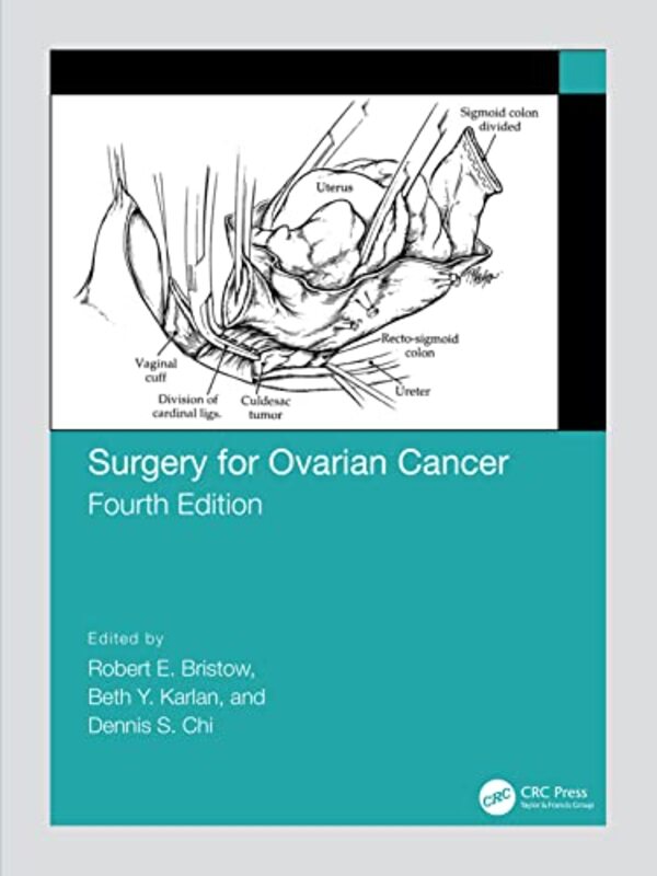 

Surgery for Ovarian Cancer by Alice Gendron-Hardcover