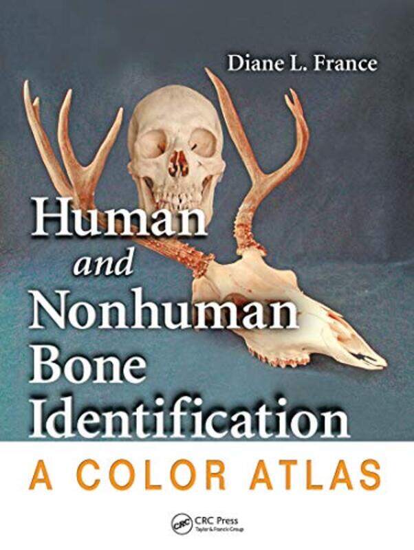 

Human and Nonhuman Bone Identification by Francesco M Bongiovanni-Paperback