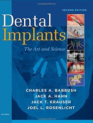 Dental Implants By Charles A Babbush Director Clearchoice Dental Implant Center Clinical Professor Department Of O Hardcover