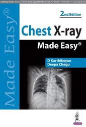 Chest Xray Made Easy By Karthikeyan, D. - Chegu, Deepa Paperback