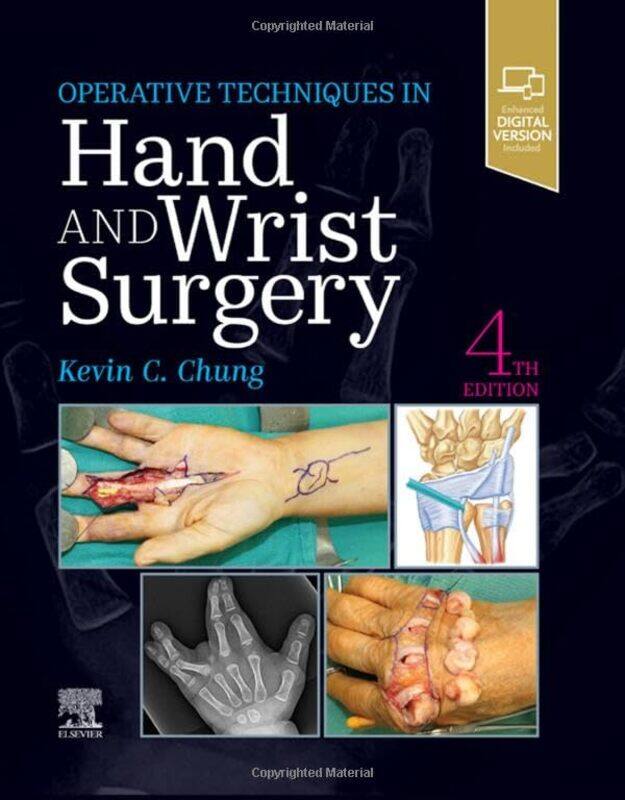 

Operative Techniques Hand and Wrist Surgery by Raymond Buckland-Hardcover