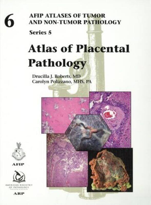 

Atlas of Placental Pathology by Egbert Universiteit Leiden FortuinHetty Universiteit Leiden Geerdink-Verkoren-Hardcover