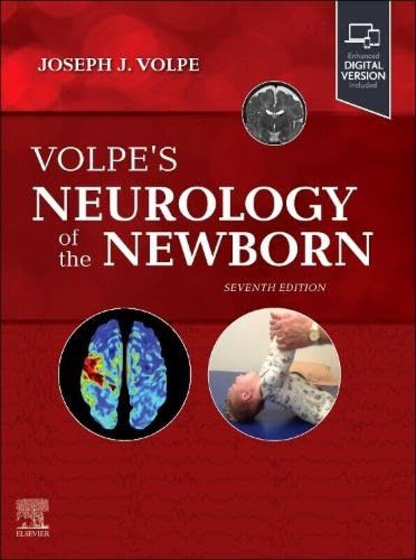 

Volpes Neurology of the Newborn by Elise Hu-Hardcover