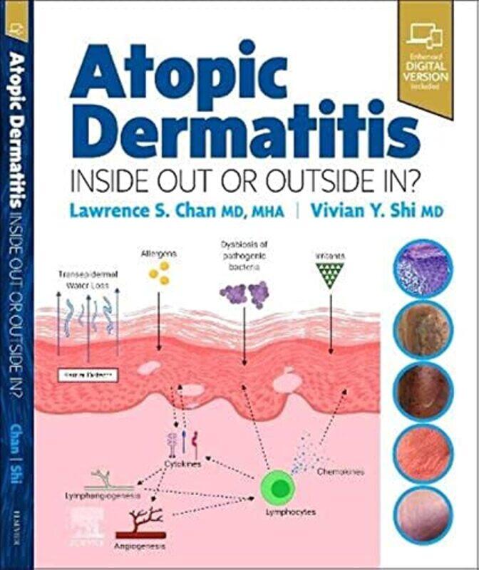 

Atopic Dermatitis Inside Out or Outside In by Sun Kuie S'pore General Hospital S'pore Duke-nus Medical School S'pore Tay-Hardcover