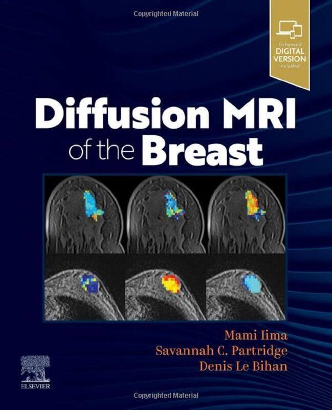 

Diffusion MRI of the Breast by United Nations Development Programme-Paperback