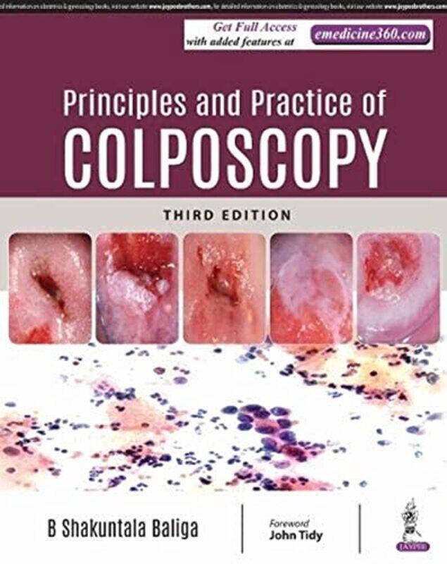 

Principles and Practice of Colposcopy,Hardcover,by:B Shakuntala Baliga