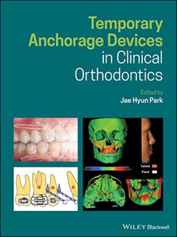 

Temporary Anchorage Devices In Clinical Orthodontics by Jae Hyun (Arizona School of Dentistry and Oral Health) Park-Hardcover