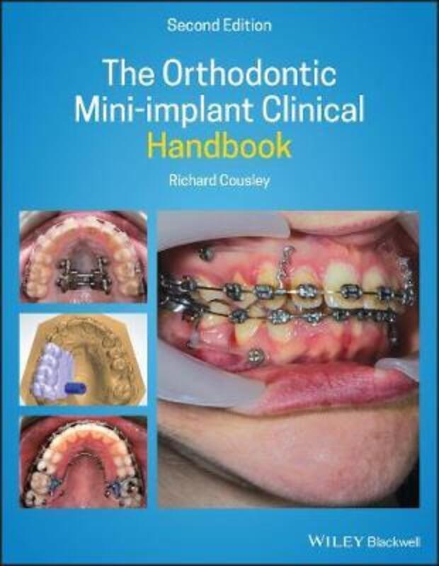 The Orthodontic Mini-implant Clinical Handbook.Hardcover,By :Cousley, Richard