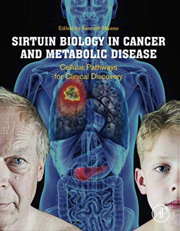 

Sirtuin Biology in Cancer and Metabolic Disease by Allan Ahlberg-Paperback