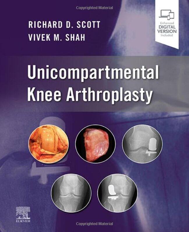 

Unicompartmental Knee Arthroplasty by Jana Eger-Hardcover