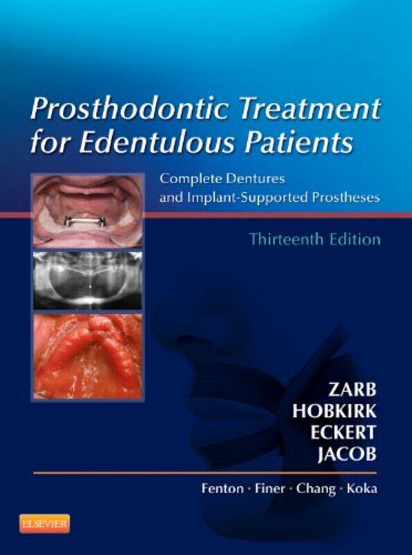 

Prosthodontic Treatment For Edentulous Patients by Rhonda..Paperback