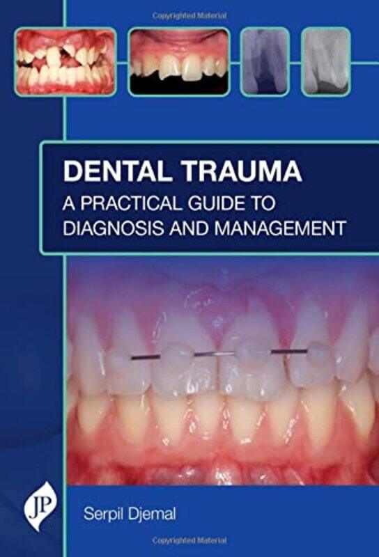 

Dental Trauma by Serpil Djemal-Hardcover