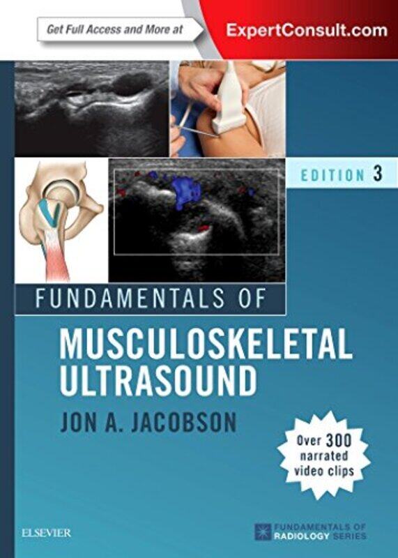 

Fundamentals Of Musculoskeletal Ultrasound By Jacobson, Jon A. (Associate Professor of Radiology; Director, Division of Musculoskeletal Radiology, Pap