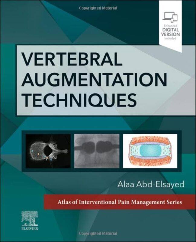

Vertebral Augmentation Techniques By Alaa Md Mph Fasa ...Hardcover