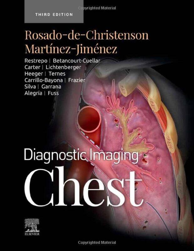 

Diagnostic Imaging Chest by Andrew University of Leicester King-Hardcover