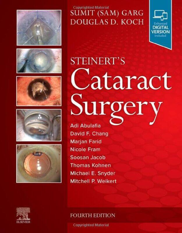 

Steinerts Cataract Surgery by Martin Popoff-Hardcover