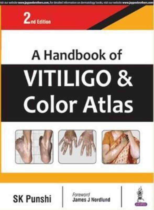 

A Handbook of Vitiligo & Color Atlas.paperback,By :Punshi, S. K.