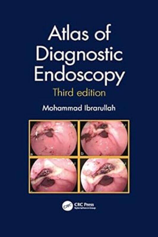 

Atlas Of Diagnostic Endoscopy 3E