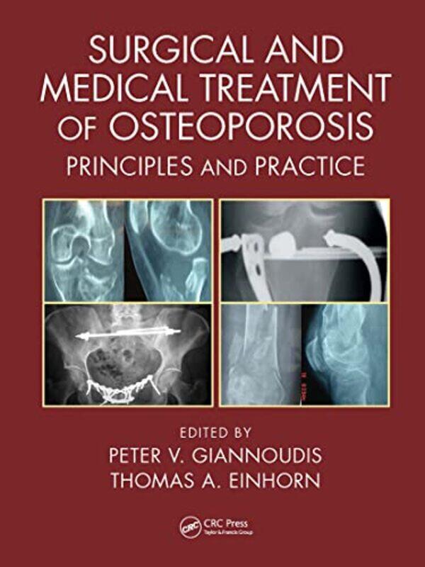 

Surgical and Medical Treatment of Osteoporosis by Scott E Page-Paperback