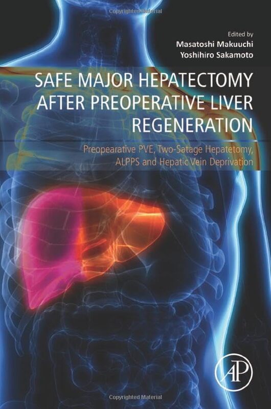 Safe Major Hepatectomy after Preoperative Liver Regeneration by Yoshihiro, MD, PhD (Kyorin University Hospital, Mitaka, Tokyo) SakamotoMasatoshi (Koto Hospital, Koto City, Tokyo) Makuuchi -Paperback