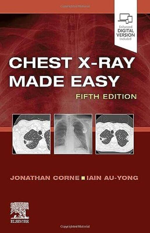 

Chest XRay Made Easy by Federico Queen's University Belfast Lupo-Pasini-Paperback