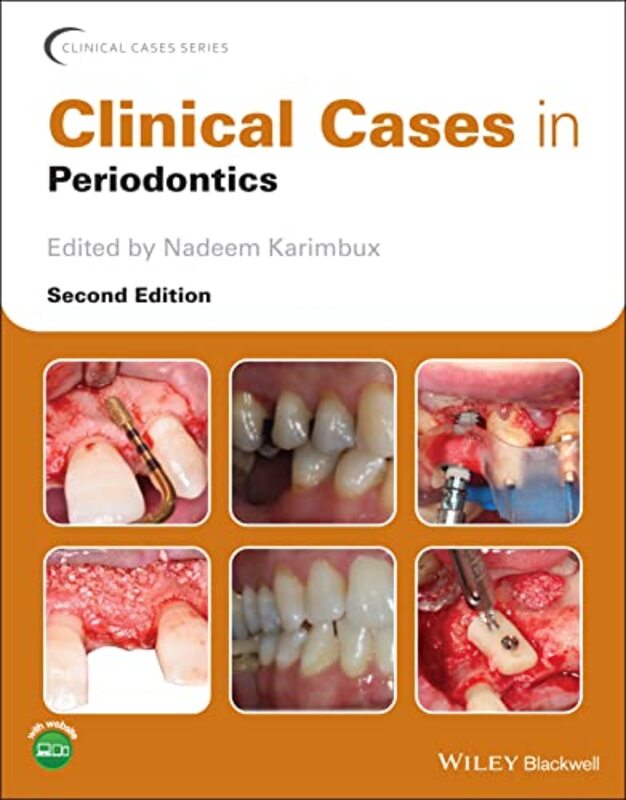 Clinical Cases in Periodontics 2e,Paperback by N Karimbux