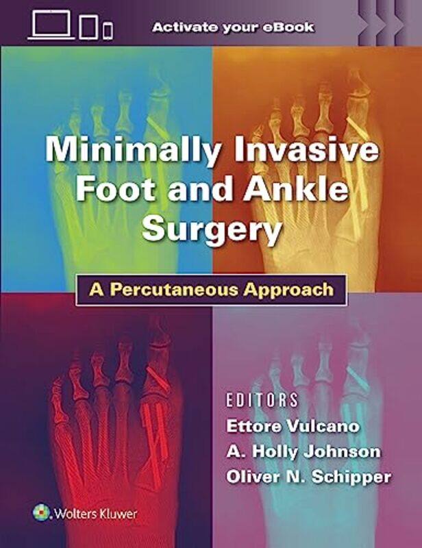 

Minimally Invasive Foot and Ankle Surgery by Walter D Mignolo-Hardcover