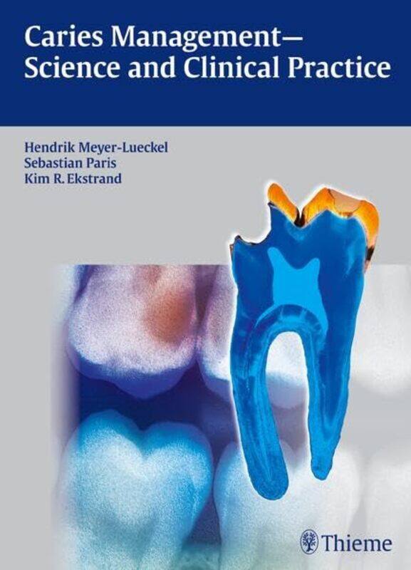 

Caries Management Science And Clinical Practice by Hendrik Meyer-LuckelSebastian ParisKim Ekstrand-Hardcover
