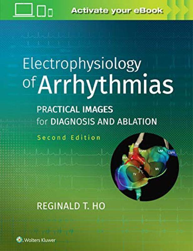 

Electrophysiology of Arrhythmias by Helen Freelance historian Bynum-Hardcover