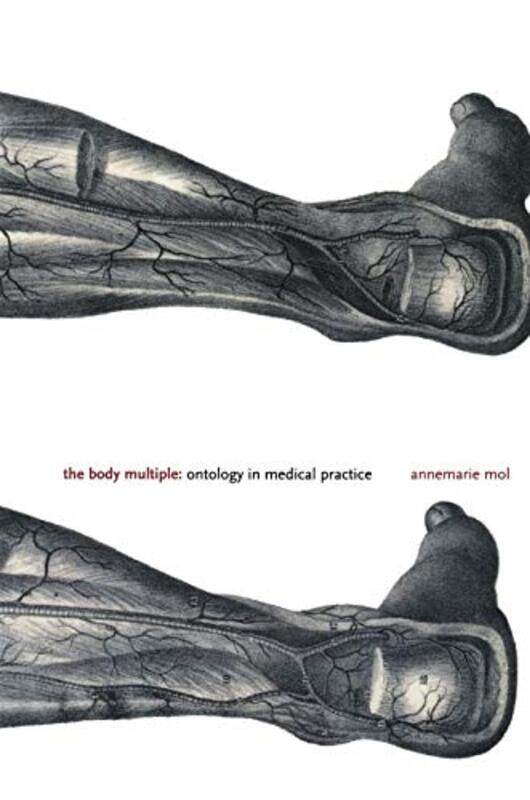 

The Body Multiple by Kate Messner-Paperback