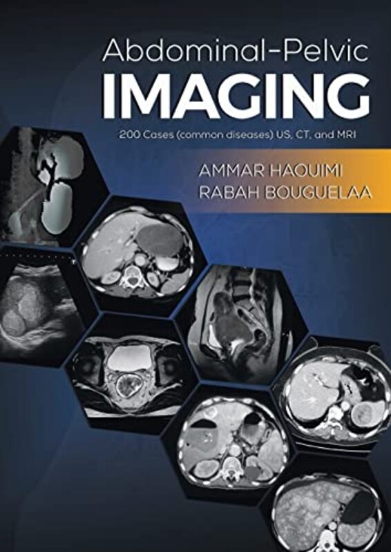 

AbdominalPelvic Imaging by Ammar HaouimiRabah Bouguelaa-Paperback