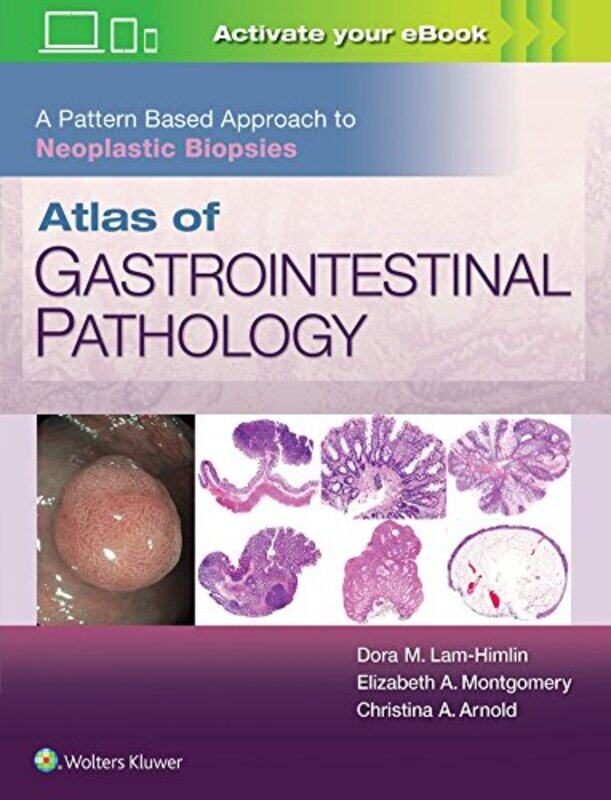 

Atlas of Gastrointestinal Pathology A Pattern Based Approach to Neoplastic Biopsies by Jeanne LiEDT PerfumekaAndrew Book Reviews Editor Renaissance Studies Ki