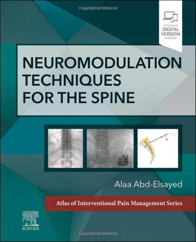 

Neuromodulation Techniques for the Spine by Rachel Patterson-Hardcover