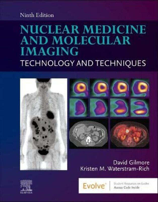 

Nuclear Medicine and Molecular Imaging by William Hartston-Paperback