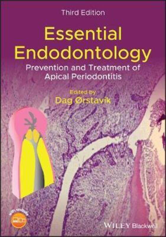 

Essential Endodontology - Prevention and Treatment of Apical Periodontitis, 3rd Edition,Hardcover,ByOrstavik